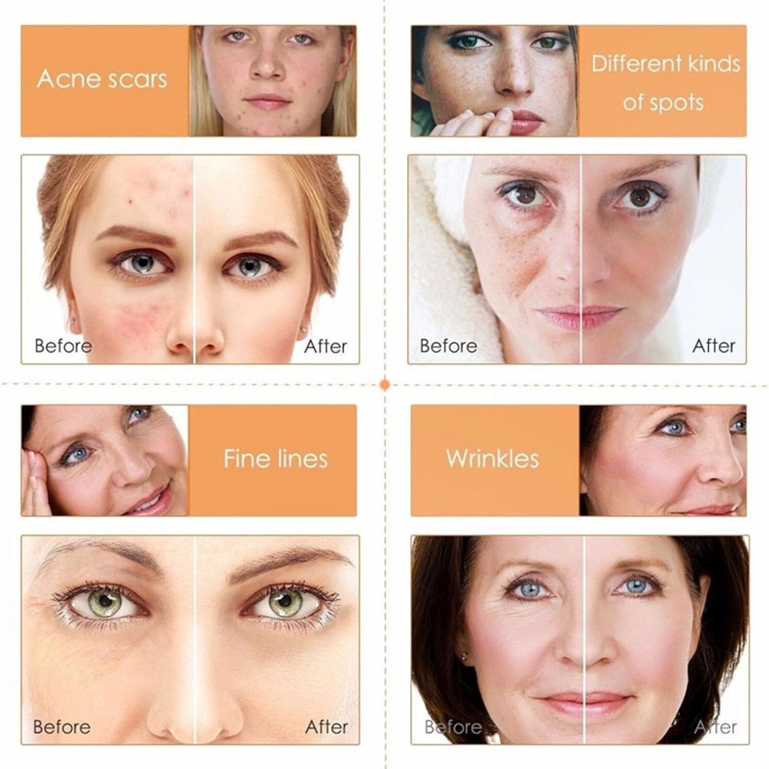 Vitamin C Skincare Set, 5-In-1 Skincare Gift Set With Cleanser, Toner, Face Serum, Face Cream, And Eye Cream, Skin Care Products For Teen Girls, Long-Lasting Moisturizing Skincare Set For Women Men - Image 5